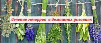 народная медицина для лечения геморроя